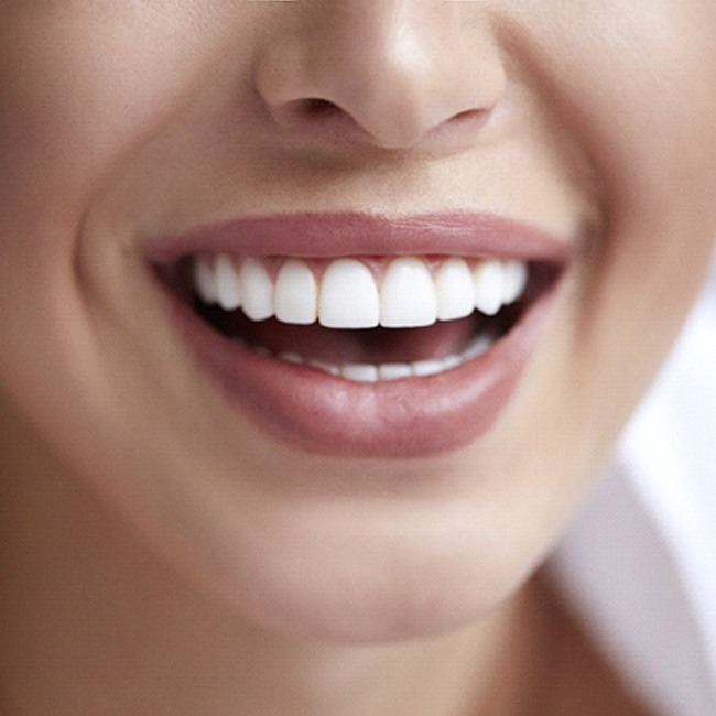 Closeup of smiling woman with veneers in Van Nuys